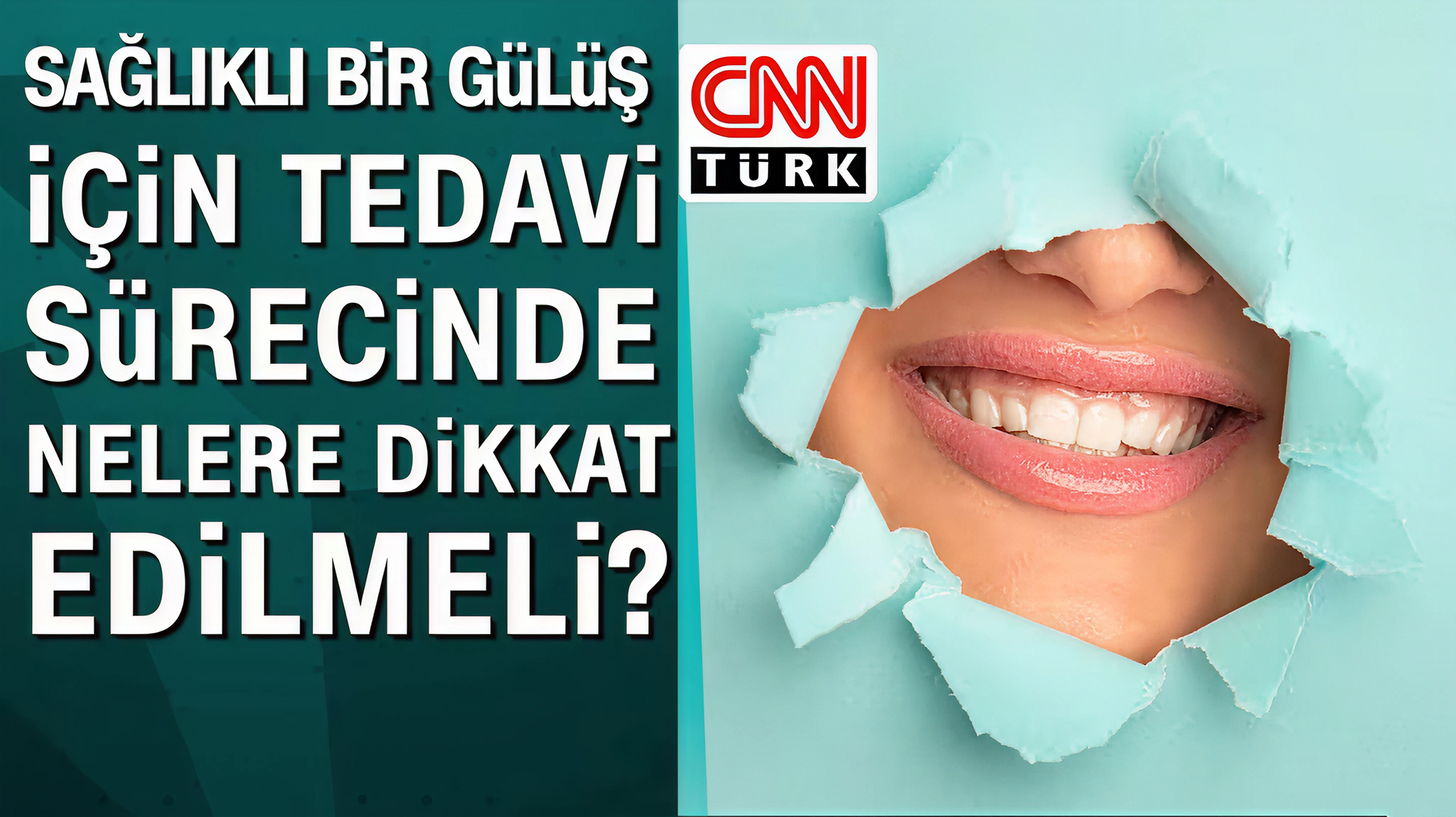 Sağlıklı bir gülüş için tedavi sürecinde nelere dikkat edilmelidir?
